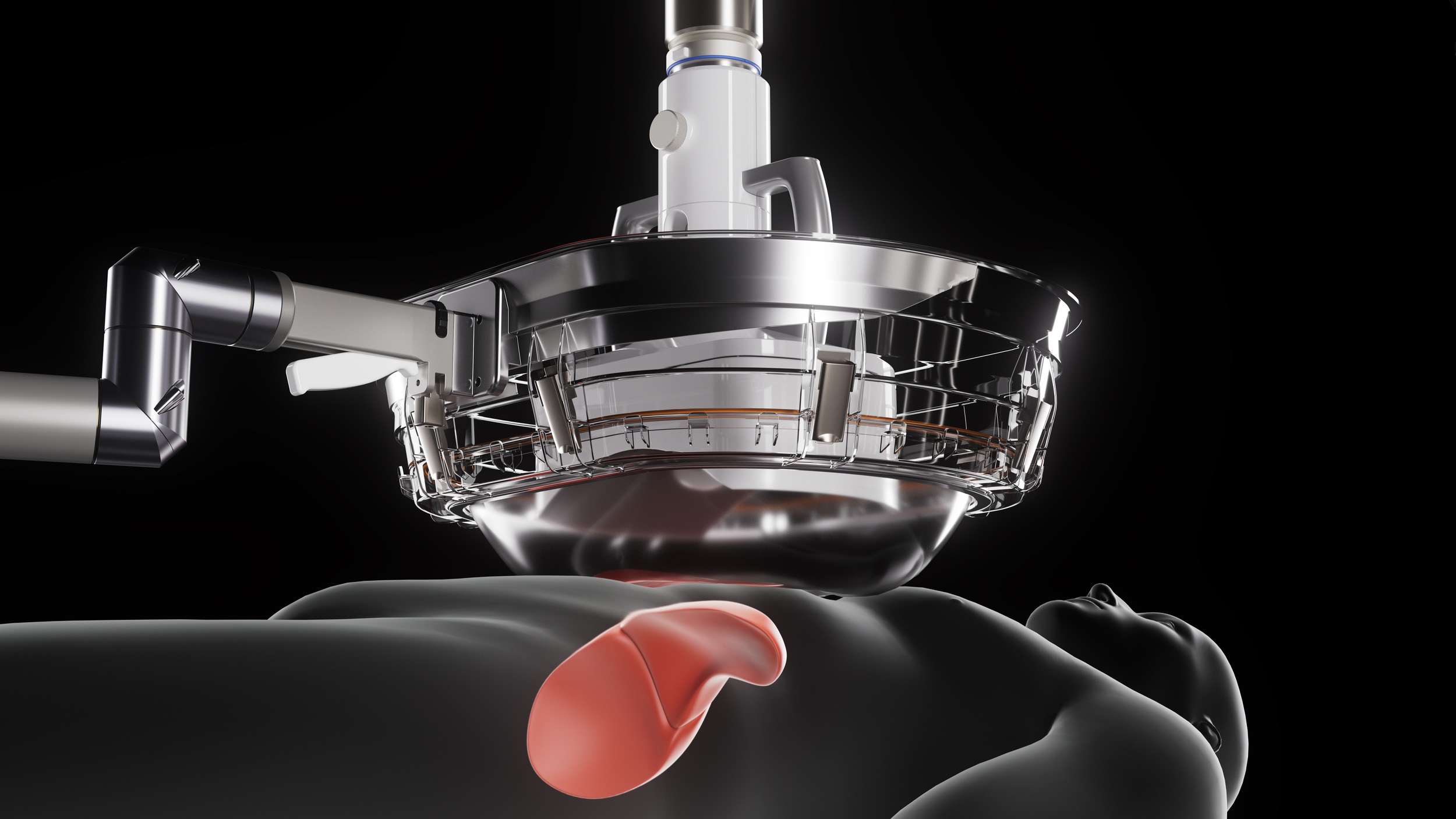 Courtesy of HistoSonics - Edison-System-with-Patient-Coupling-Kit-1