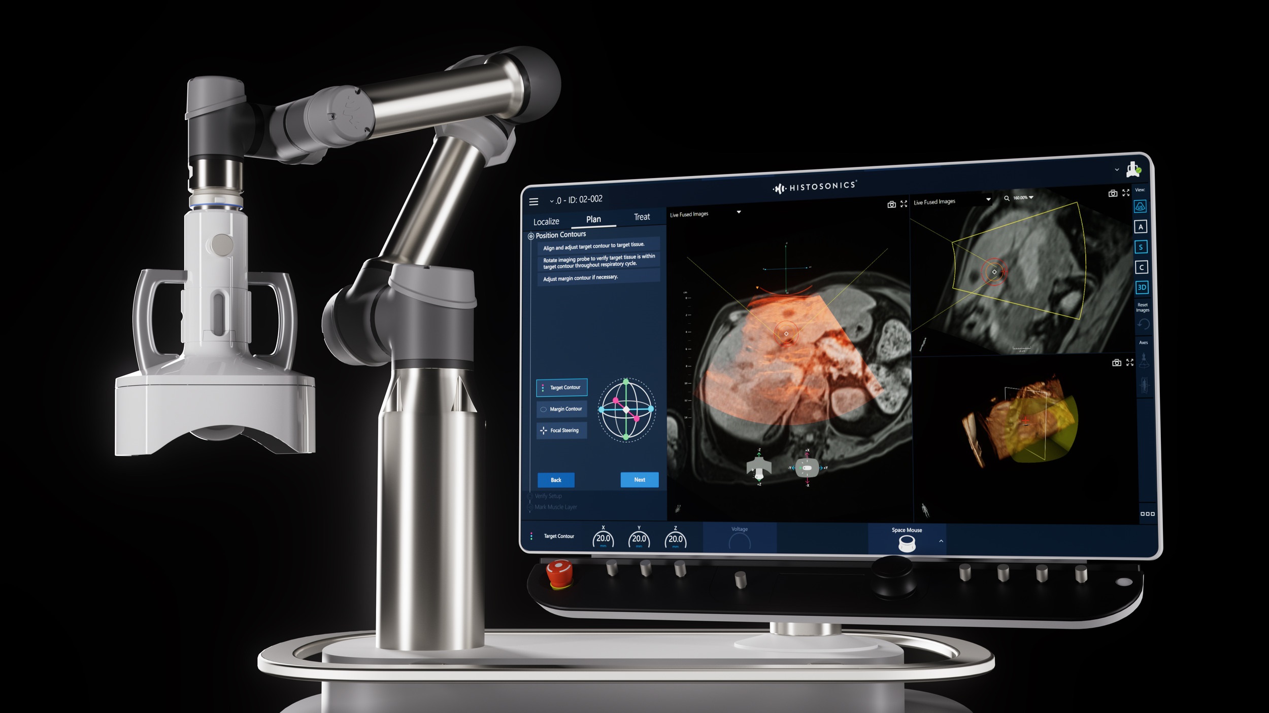 Courtesy of HistoSonics - Edison-with-Interface-Zoom-1