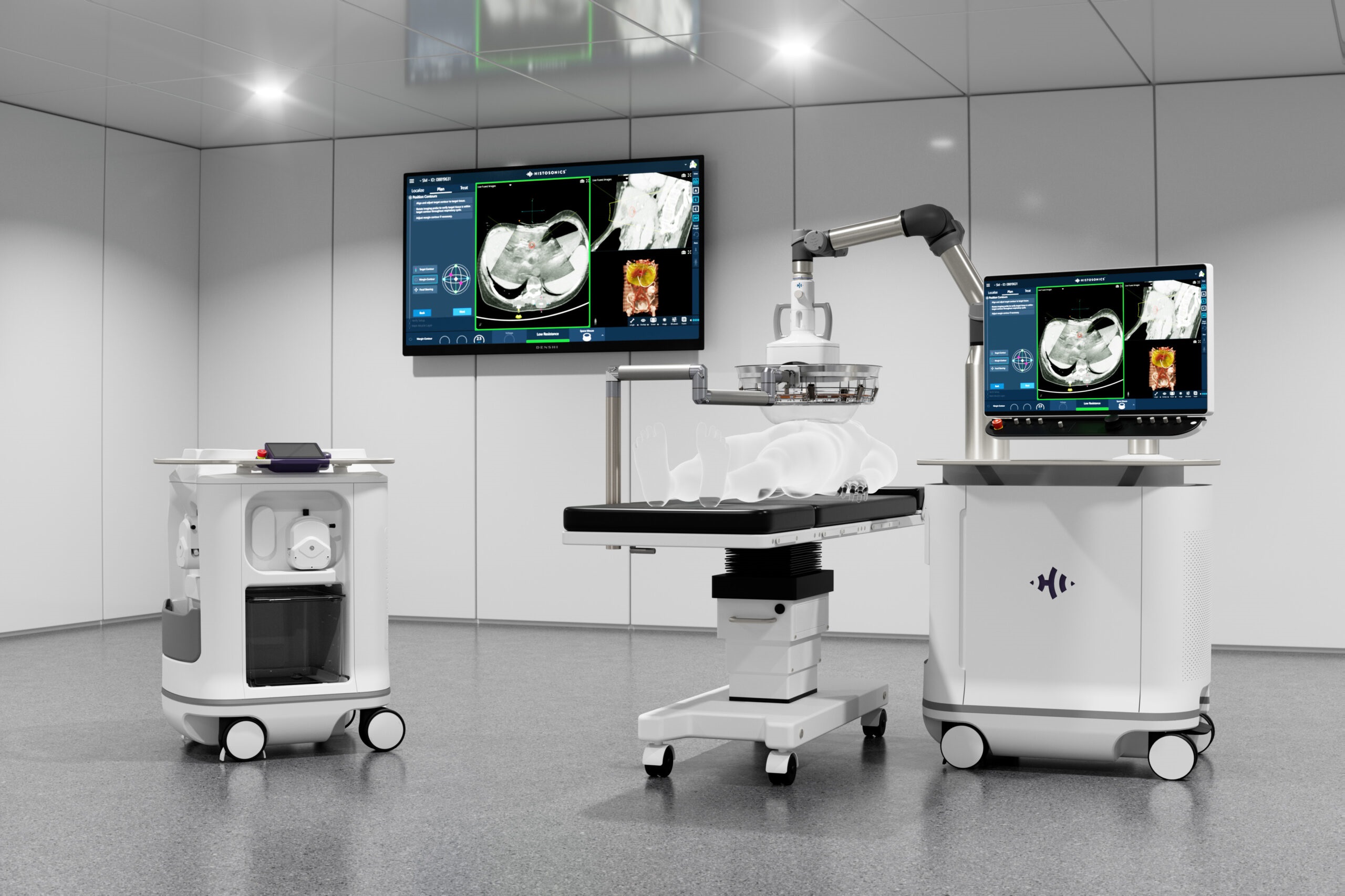 Courtesy of HistoSonics - Edison_OR_Suite_R3-scaled